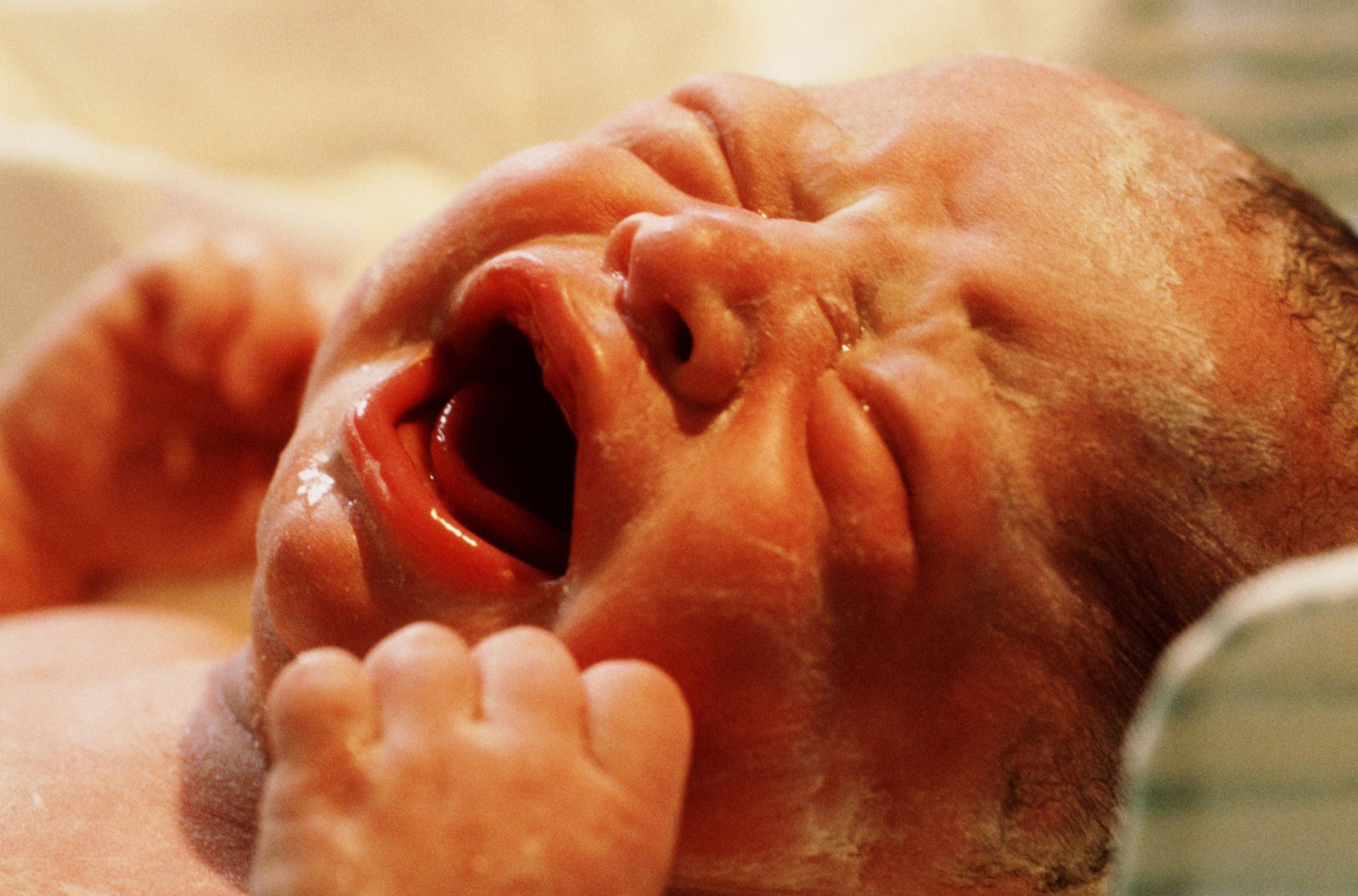 NEWBORN BABY IN HOSPITAL